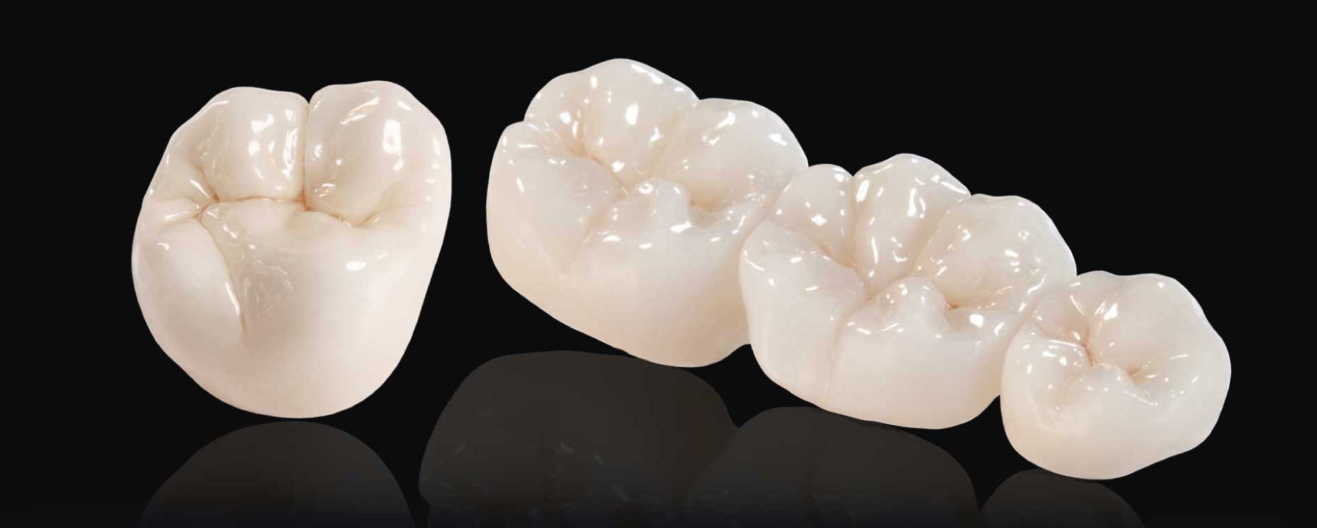 Coronas Libres de Metal - Clínicas White - Restaura tu dentadura